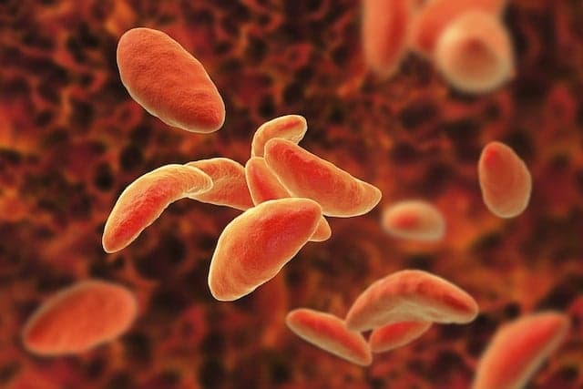 Toxoplasmose e o direito ao auxílio-acidente