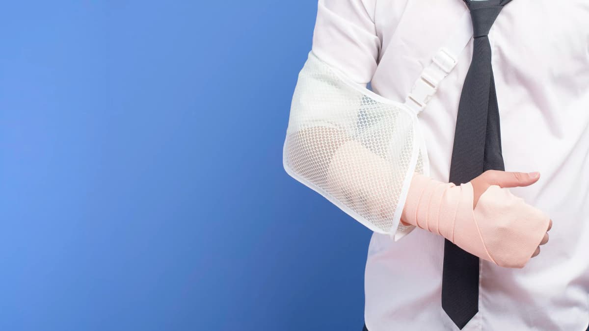 Redução mínima da capacidade ao trabalho dá direito a auxílio-acidente.