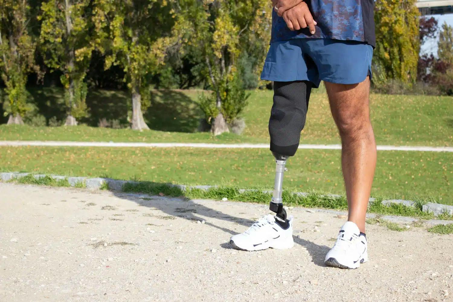 INSS deve fornecer prótese adequada a segurado que teve perna amputada em acidente