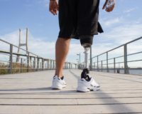 INSS deve arcar com os custos de próteses para perna de segurado